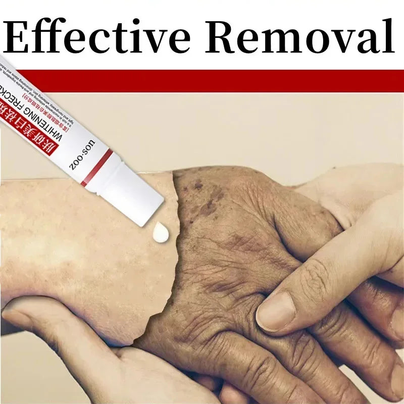 Dark Spot Corrector Gel with Niacinamide 20ml by HitMyNeed