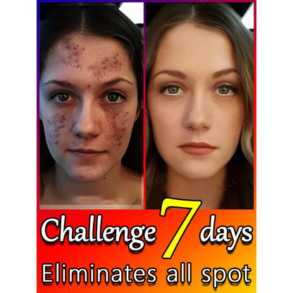 Dark Spot & Freckle Correcting Brightening Cream by HitMyNeed