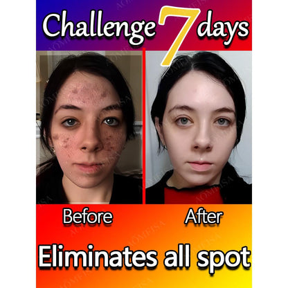 Dark Spot & Freckle Correcting Brightening Cream by HitMyNeed