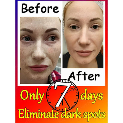 Dark Spot & Freckle Correcting Brightening Cream by HitMyNeed