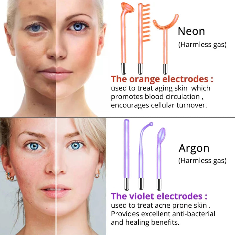 Darsonval High Frequency Facial Machine with 6 Wands by HitMyNeed