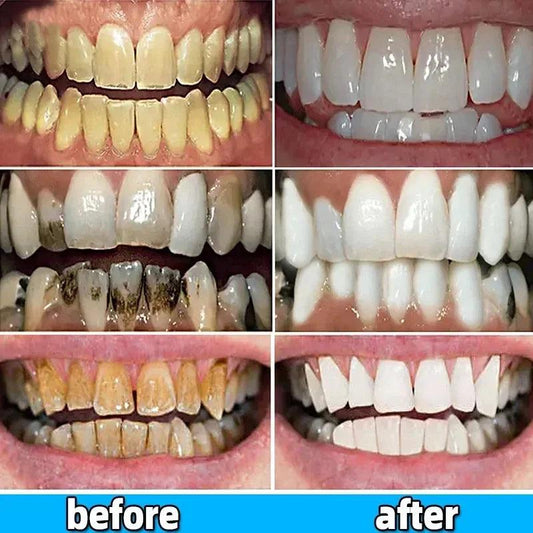 Dental Calculus Remover & Whitening Toothpaste 100g by HitMyNeed