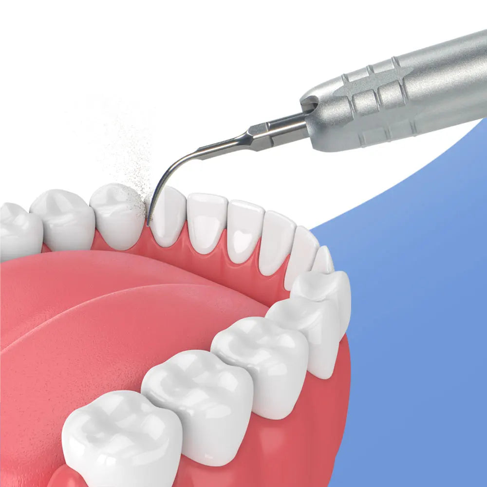 Dental Ultrasonic Air Scaler Handpiece with 3 Tips by HitMyNeed