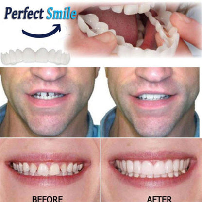Dental Veneers Teeth Caps - Temporary Cosmetic Cover by HitMyNeed