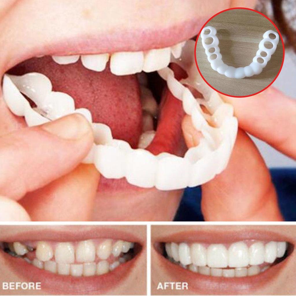 Dental Veneers Teeth Caps - Temporary Cosmetic Cover by HitMyNeed