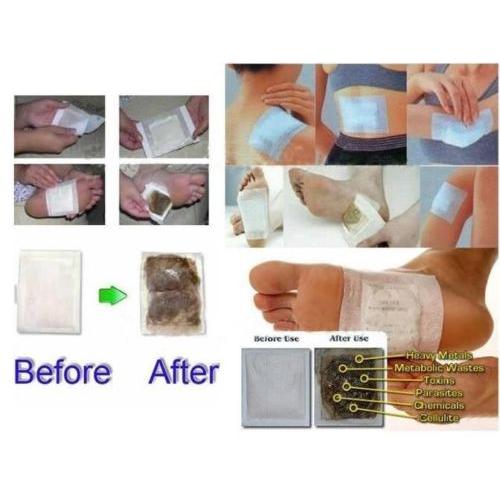 Detox Foot Patch Adhesives Set, 20 Pieces by HitMyNeed