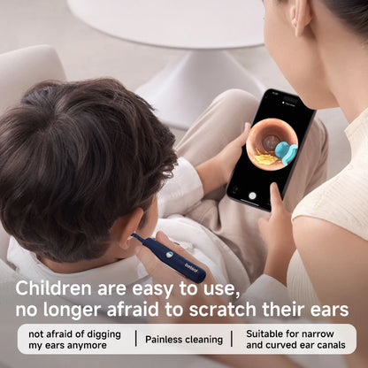 EarSight Plus Visual Bendable Earwax Removal Kit by HitMyNeed