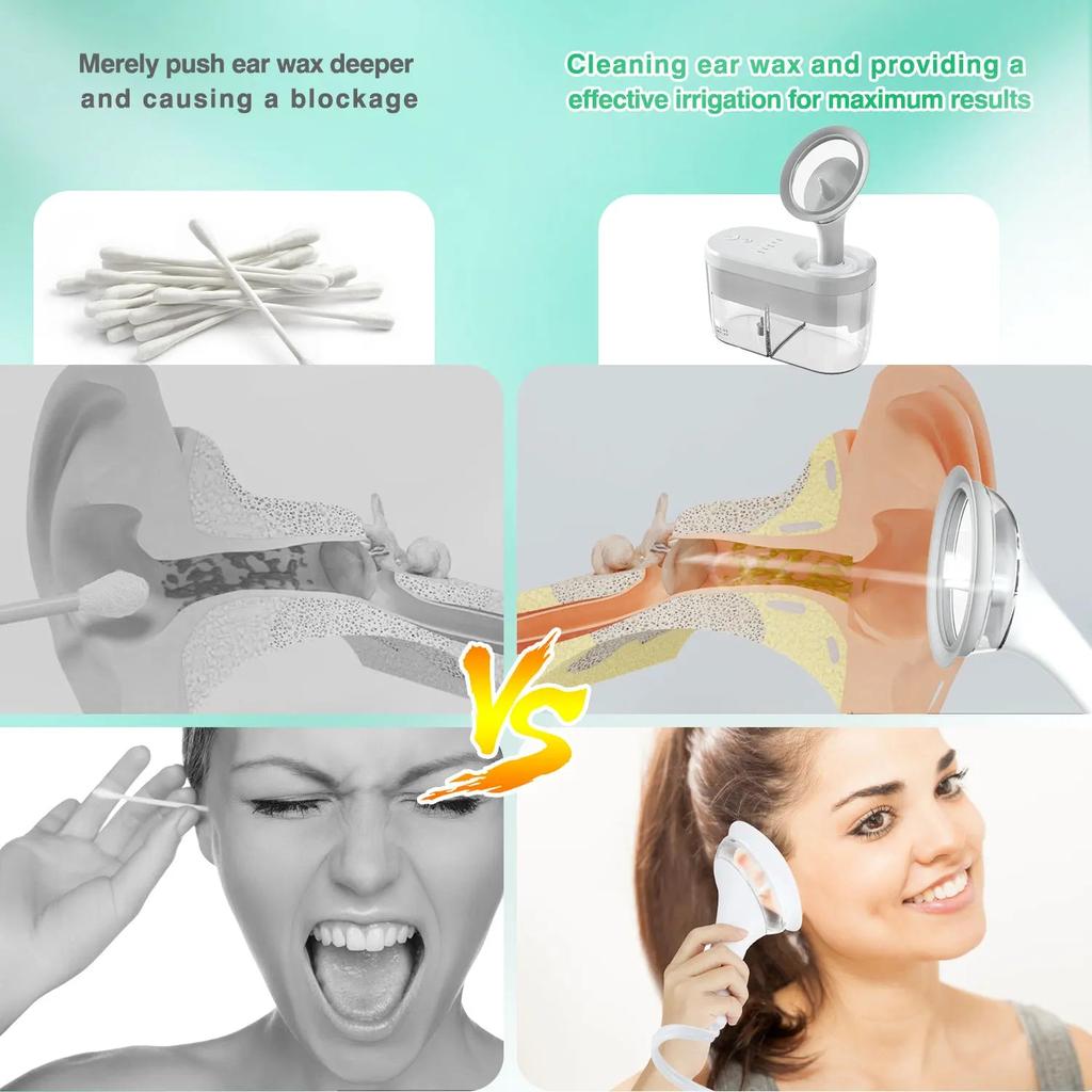 Electric Ear Irrigation Earwax Removal Kit by HitMyNeed