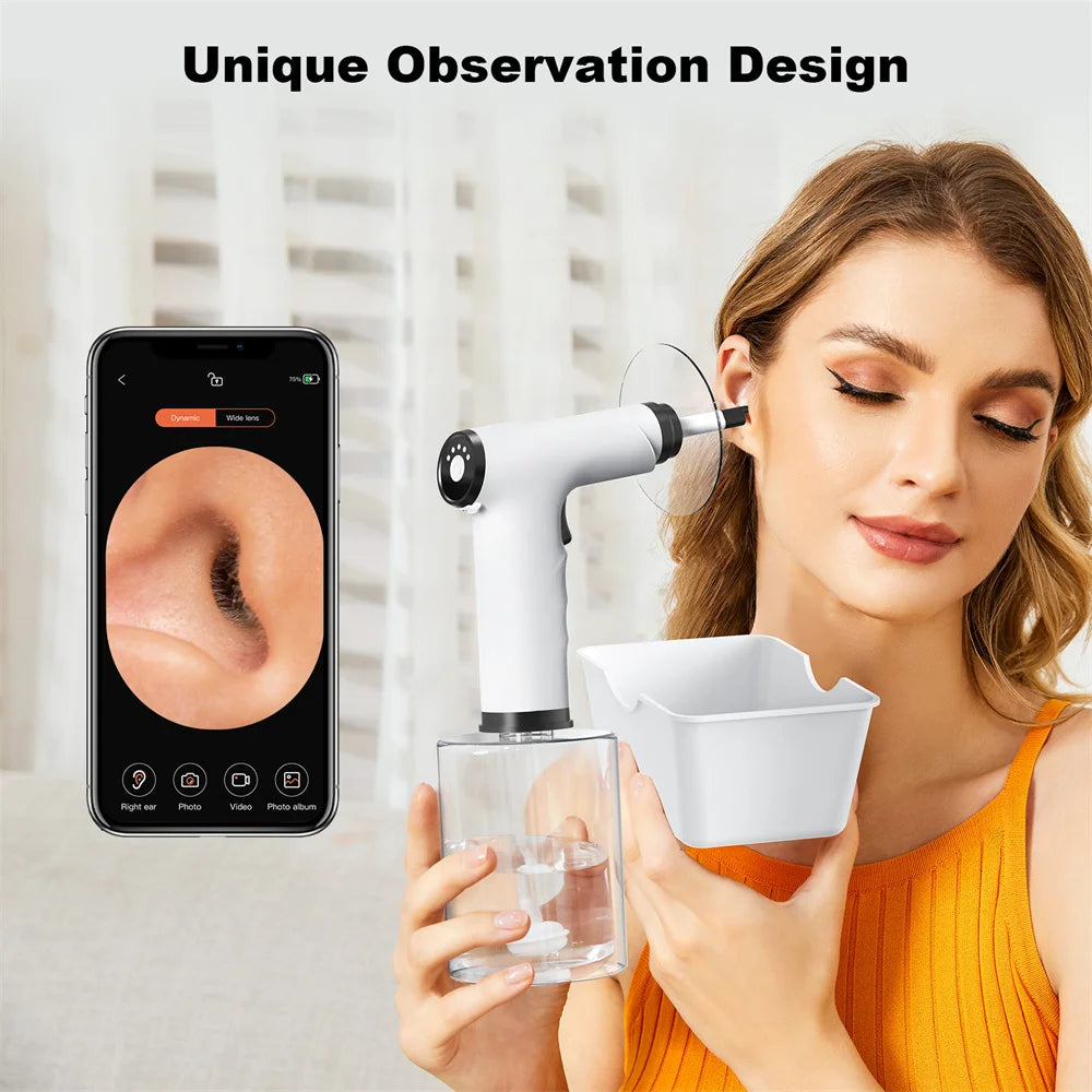 Electric Ear Wax Removal Kit with 4 Spray Settings by HitMyNeed