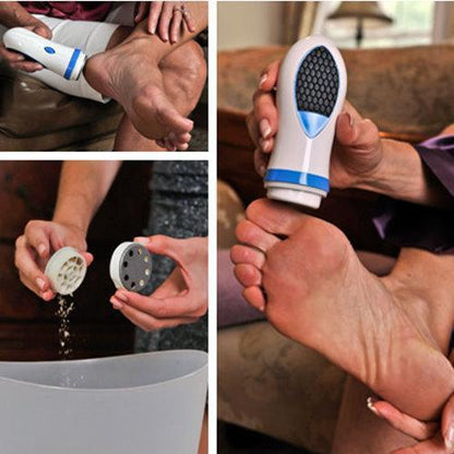 Electric Feet Dry Skin & Callus Remover by HitMyNeed