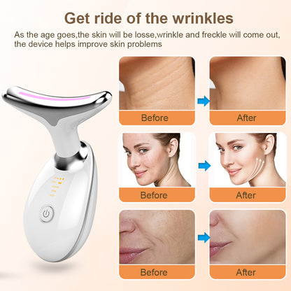 EMS Neck & Face Lifting Massager with LED Therapy by HitMyNeed