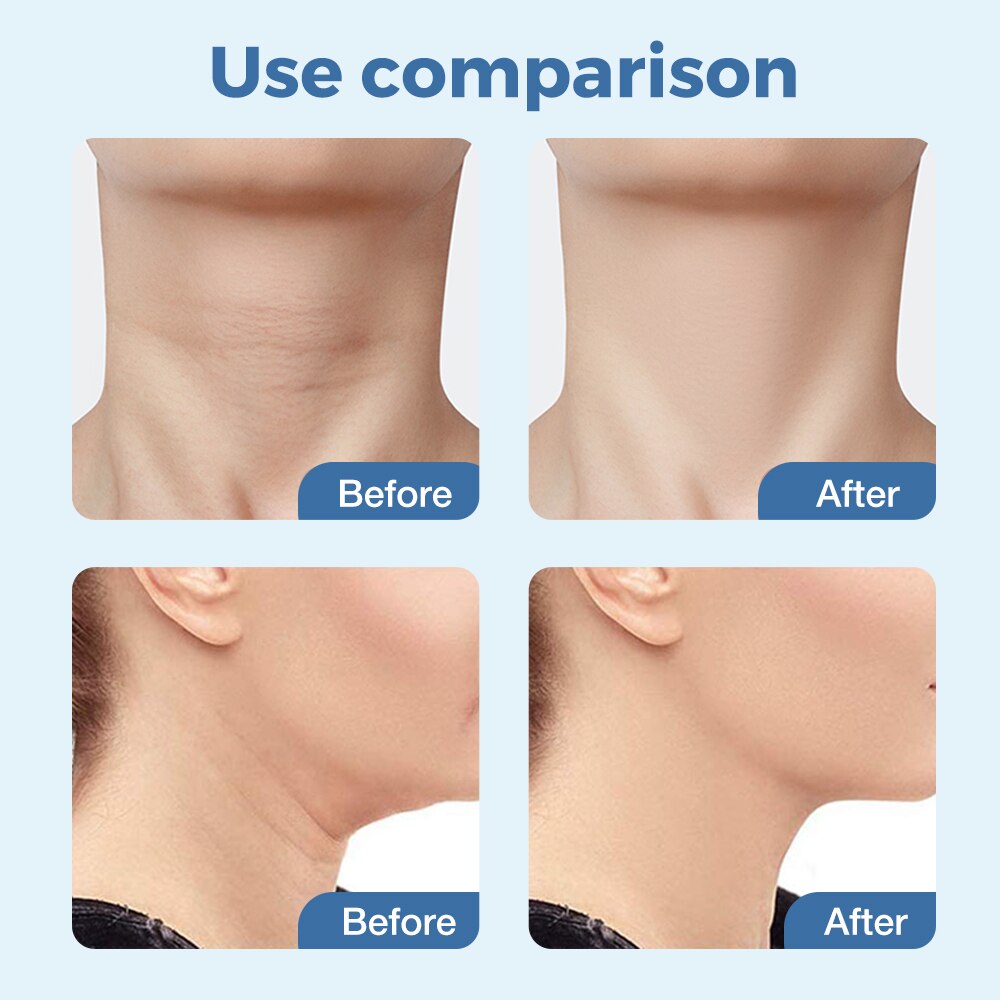 EMS Neck & Face Massager with LED Light Therapy by HitMyNeed