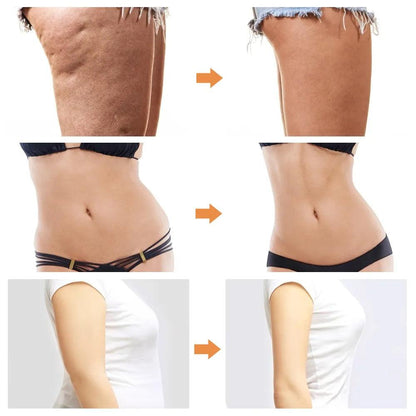 EMS VE Sport Body Shaping & Anti-Cellulite Massager by HitMyNeed