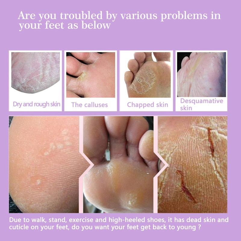 Exfoliating Foot Peel Mask for Dry, Cracked Heels by HitMyNeed