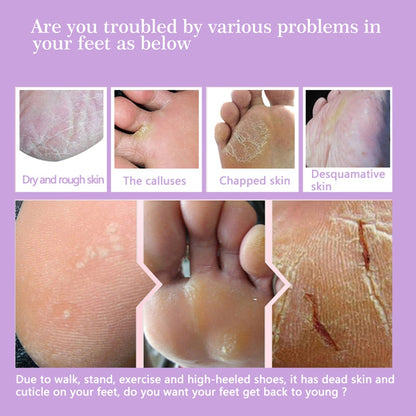 Exfoliating Foot Peel Mask for Dry, Cracked Heels by HitMyNeed
