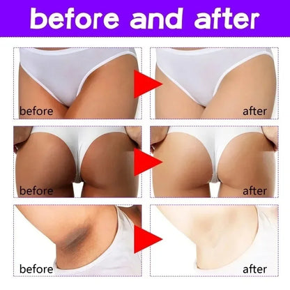 Face & Body Brightening Cream for Dark Areas by HitMyNeed