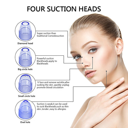 Facial Vacuum Blackhead Remover with 4 Heads by HitMyNeed