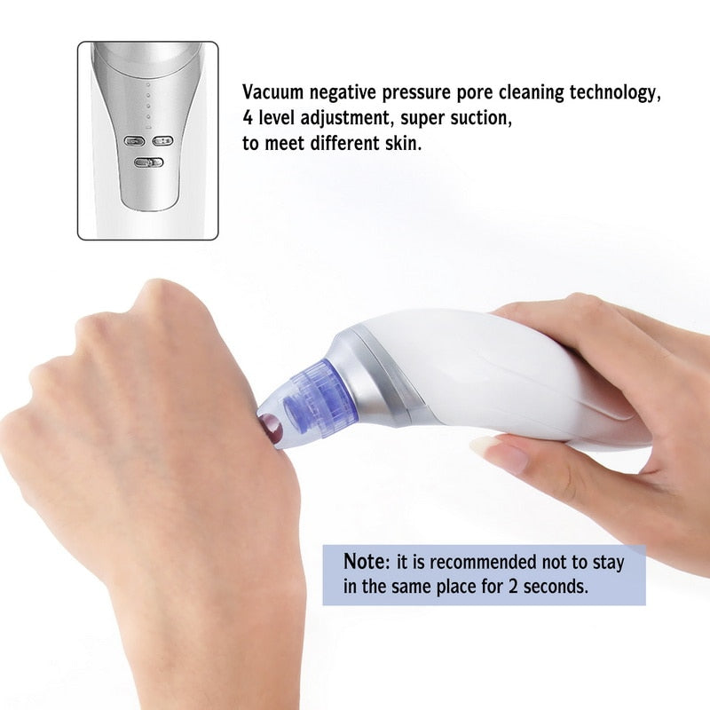 Facial Vacuum Blackhead Remover with 4 Heads by HitMyNeed