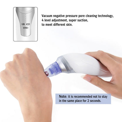Facial Vacuum Blackhead Remover with 4 Heads by HitMyNeed