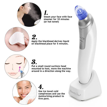 Facial Vacuum Blackhead Remover with 4 Heads by HitMyNeed