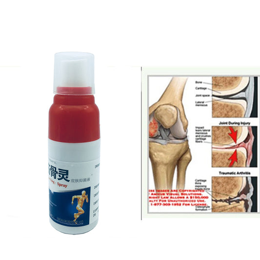 Fast-Acting Body Pain Relief Spray 30ml by HitMyNeed