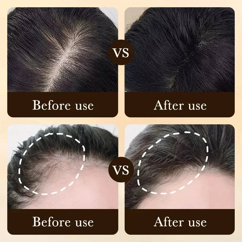 Fast Hair Growth Essence Anti-Hair Loss Serum by HitMyNeed