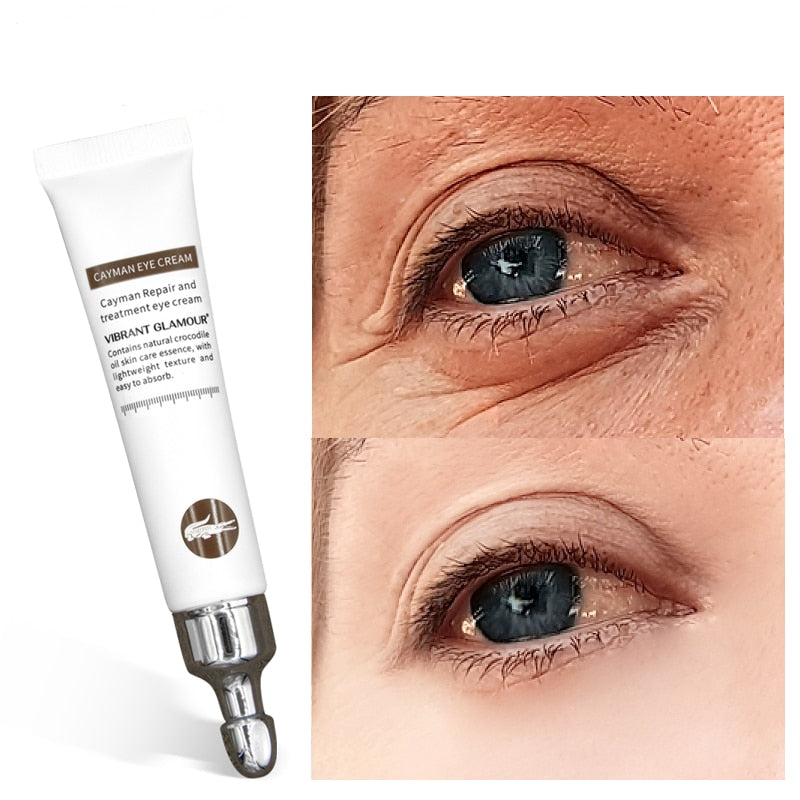 Firming Eye Cream for Wrinkles and Dark Circles by HitMyNeed