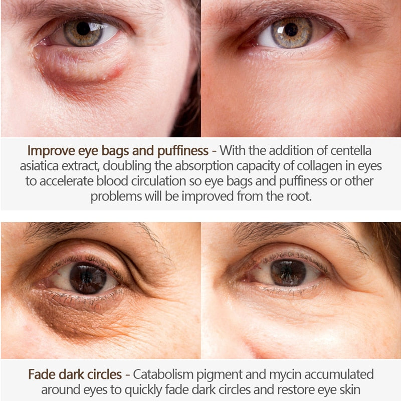Firming Eye Cream for Wrinkles and Dark Circles by HitMyNeed