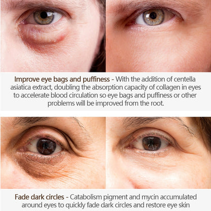Firming Eye Cream for Wrinkles and Dark Circles by HitMyNeed