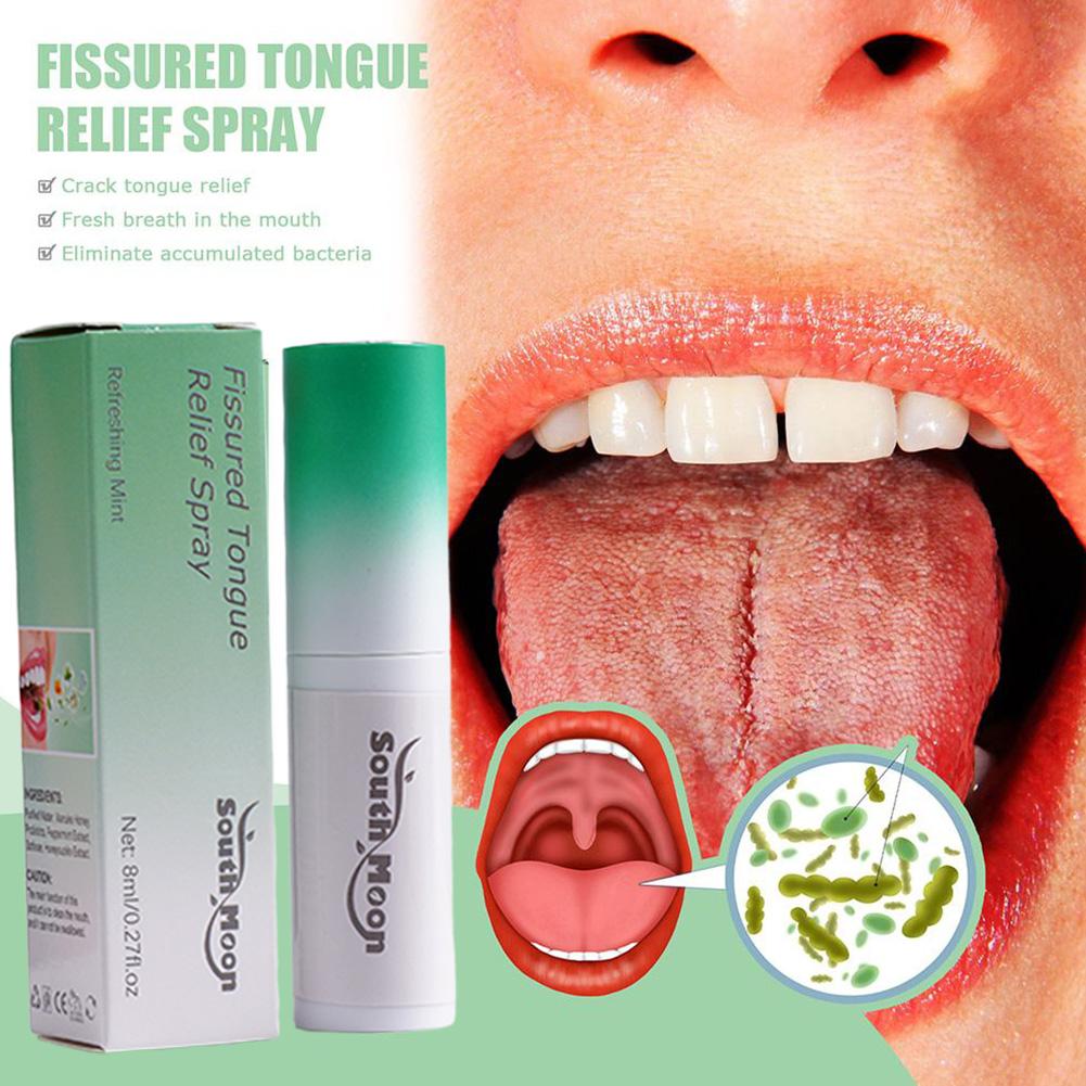 Fissured Tongue Relief & Breath Freshening Spray 8ml mint by HitMyNeed