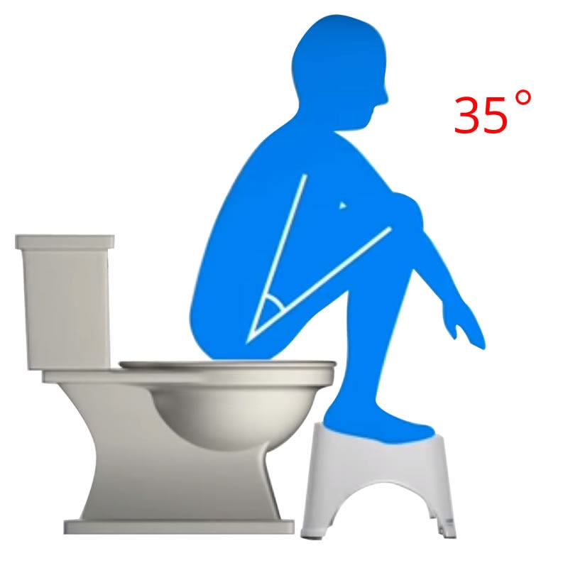 Foldable Non-Slip Toilet Footrest Squatting Stool by HitMyNeed