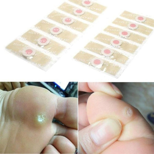 Foot Corn Removal Patches (12 Pack) by HitMyNeed