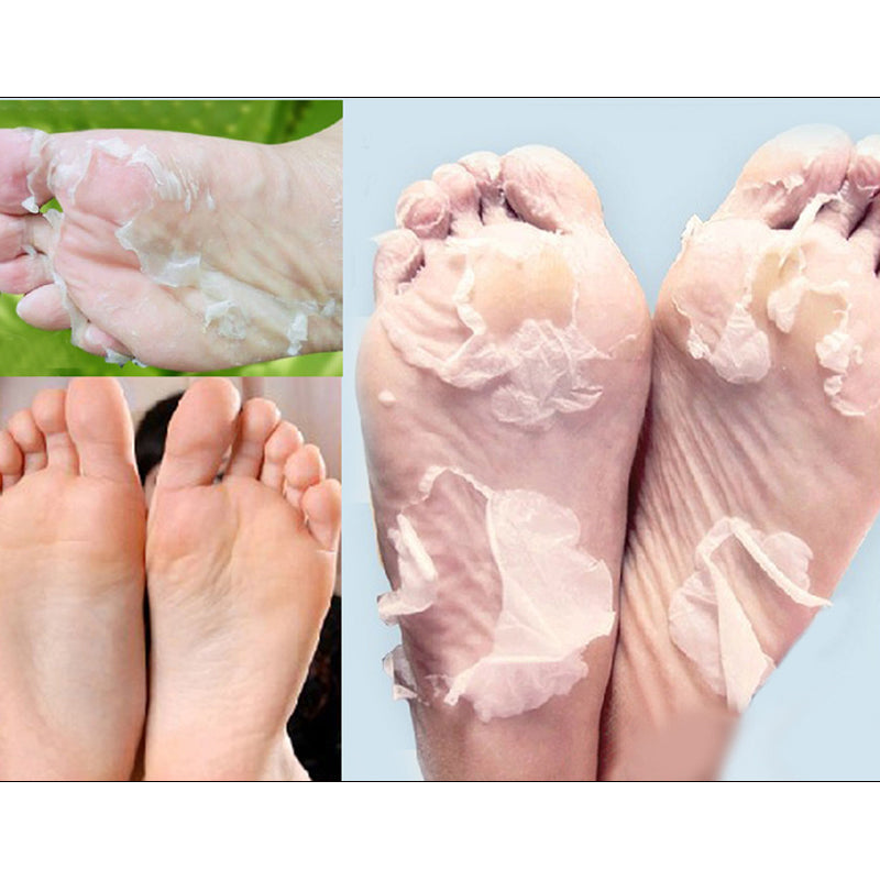 Foot Peel Mask Set of 6 for Dry, Cracked Heels by HitMyNeed
