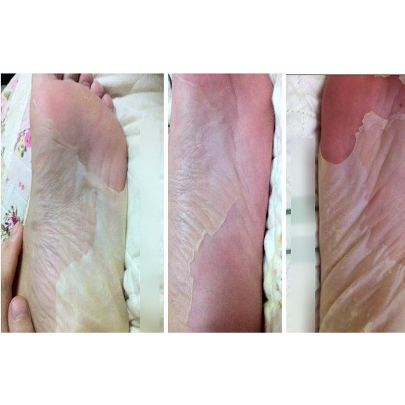 Foot Peel Mask Set of 6 for Dry, Cracked Heels by HitMyNeed