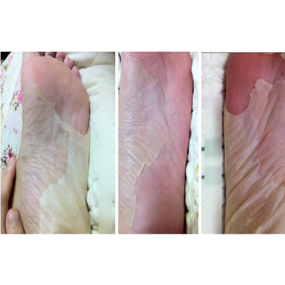 Foot Peel Mask Set of 6 for Dry, Cracked Heels by HitMyNeed