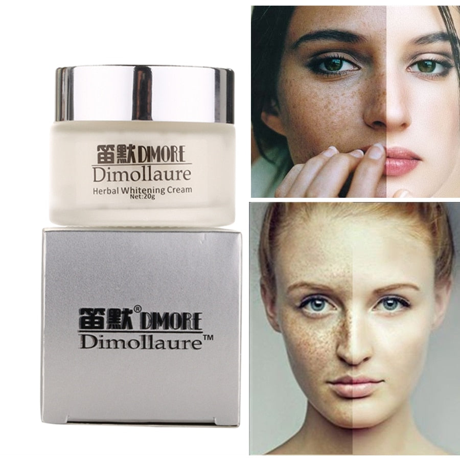 Freckle & Dark Spot Removal Face Cream 20g by HitMyNeed