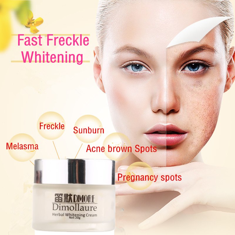 Freckle & Dark Spot Removal Face Cream 20g by HitMyNeed