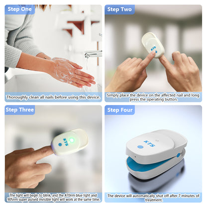 Fungal Nail Laser Treatment Device 905nm & 470nm by HitMyNeed