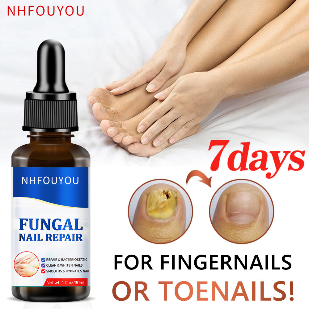 Fungal Nail Treatment Oil 10ml Foot Repair Essence by HitMyNeed