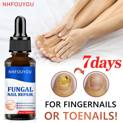Fungal Nail Treatment Oil 10ml Foot Repair Essence by HitMyNeed