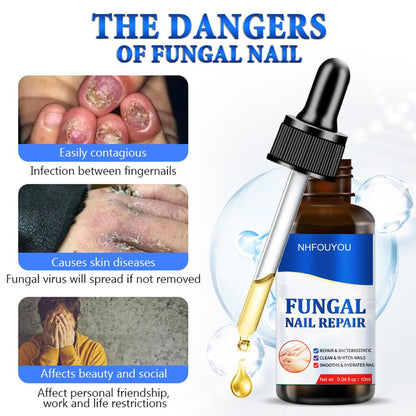 Fungal Nail Treatment Oil 10ml Foot Repair Essence by HitMyNeed