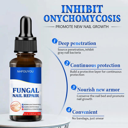 Fungal Nail Treatment Oil 10ml Foot Repair Essence by HitMyNeed