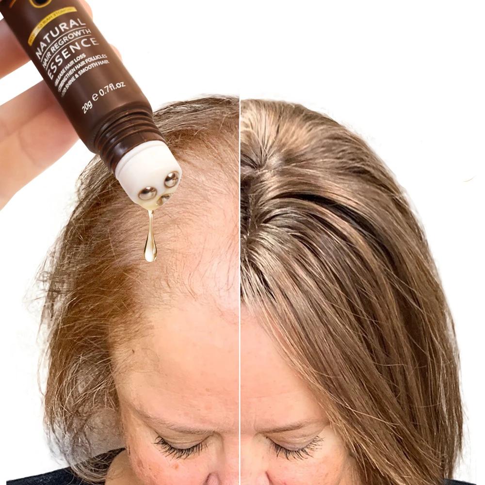 Ginger & Ginseng Hair Regrowth Roller Serum 20g by HitMyNeed