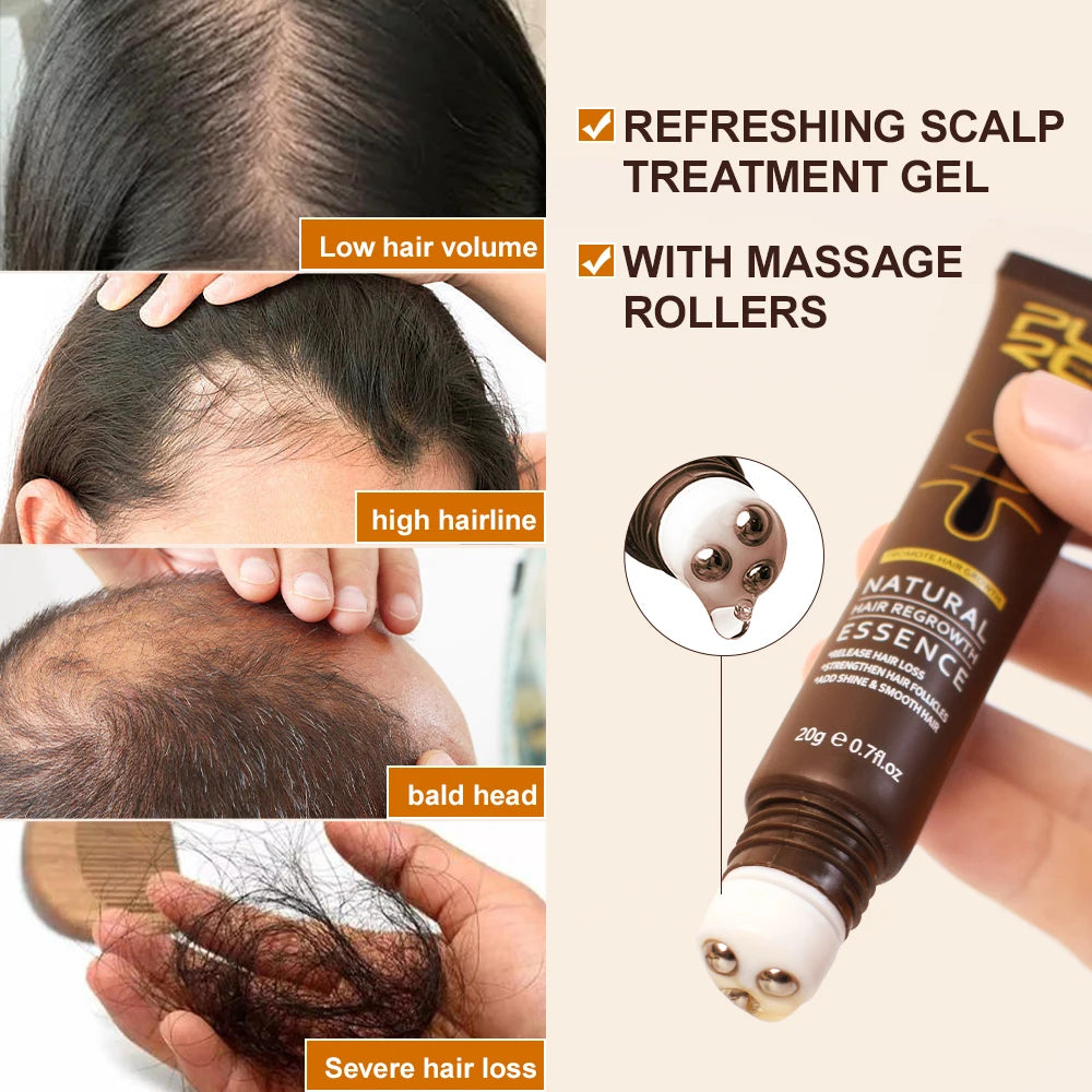 Ginger & Ginseng Hair Regrowth Roller Serum 20g by HitMyNeed