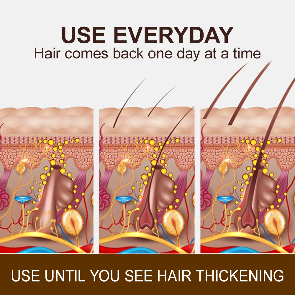 Ginger & Ginseng Hair Regrowth Roller Serum 20g by HitMyNeed