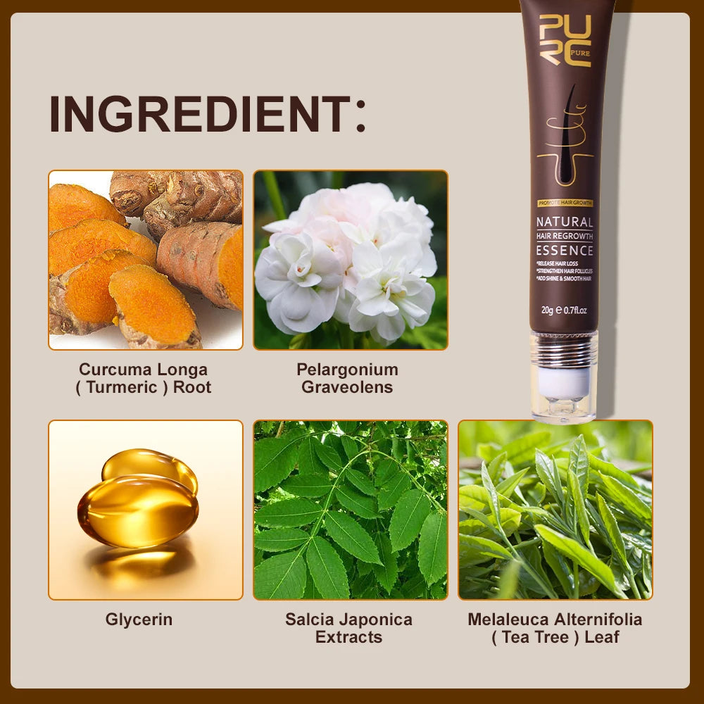Ginger & Ginseng Hair Regrowth Roller Serum 20g by HitMyNeed