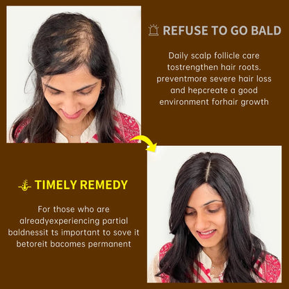 Ginger & Ginseng Hair Regrowth Roller Serum 20g by HitMyNeed