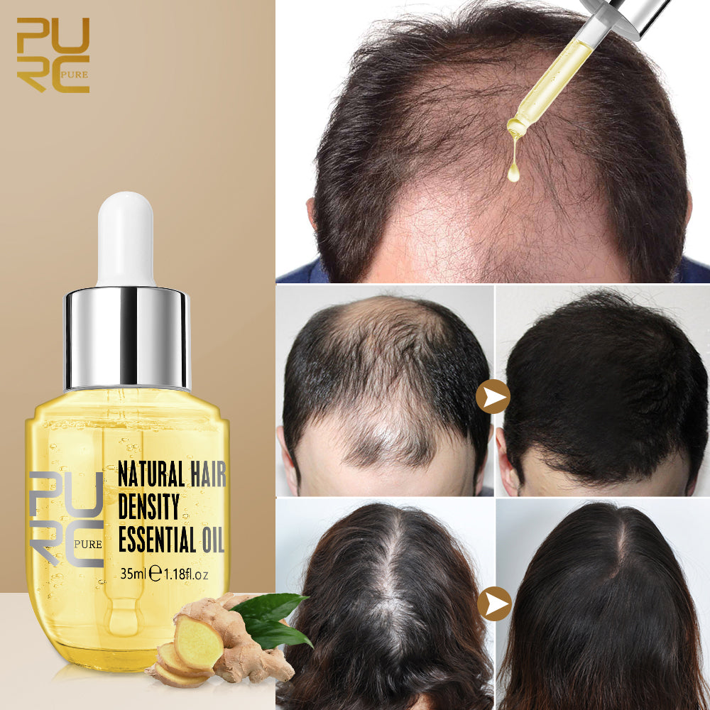 Ginger Hair Growth Oil for Thinning Hair 35ml by HitMyNeed