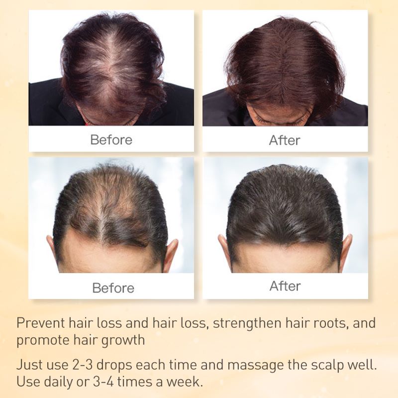 Ginger Hair Growth Oil for Thinning Hair 35ml by HitMyNeed