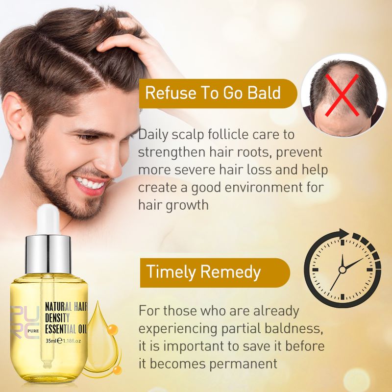 Ginger Hair Growth Oil for Thinning Hair 35ml by HitMyNeed
